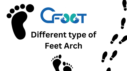 Exploring Different Types of Foot Arches: Flat Feet, High Arches, and Normal Arches
